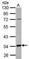 FRA10A Associated CGG Repeat 1 antibody, PA5-30979, Invitrogen Antibodies, Western Blot image 