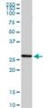 Complement C1q C Chain antibody, H00000714-D01P, Novus Biologicals, Western Blot image 