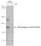 Janus Kinase 2 antibody, GTX132785, GeneTex, Western Blot image 