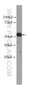 Keratin 14 antibody, 60320-1-Ig, Proteintech Group, Western Blot image 