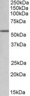 Aldehyde Dehydrogenase 6 Family Member A1 antibody, PA5-19395, Invitrogen Antibodies, Western Blot image 