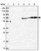 Putative uncharacterized protein LOC400499 antibody, NBP2-14519, Novus Biologicals, Western Blot image 