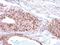 Replication factor C subunit 3 antibody, GTX103706, GeneTex, Immunohistochemistry paraffin image 