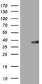 Phosphatidylinositol-4-Phosphate 3-Kinase Catalytic Subunit Type 2 Alpha antibody, TA801731, Origene, Western Blot image 