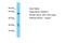 Kazal Type Serine Peptidase Inhibitor Domain 1 antibody, A12419, Boster Biological Technology, Western Blot image 
