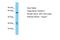 Kazal Type Serine Peptidase Inhibitor Domain 1 antibody, A12419, Boster Biological Technology, Western Blot image 