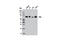 Spleen Associated Tyrosine Kinase antibody, 13198T, Cell Signaling Technology, Western Blot image 