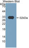 Epidermal Growth Factor antibody, LS-C314546, Lifespan Biosciences, Western Blot image 