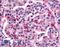Frizzled Class Receptor 5 antibody, LS-A4278, Lifespan Biosciences, Immunohistochemistry paraffin image 
