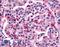 Frizzled-5 antibody, LS-A4278, Lifespan Biosciences, Immunohistochemistry paraffin image 