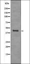 Eukaryotic Translation Initiation Factor 2 Alpha Kinase 4 antibody, orb335822, Biorbyt, Western Blot image 
