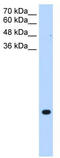 Transmembrane protein 75 antibody, TA336011, Origene, Western Blot image 