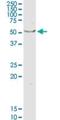 3-Oxoacid CoA-Transferase 1 antibody, H00005019-D01P, Novus Biologicals, Western Blot image 