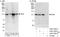 DIS3 Homolog, Exosome Endoribonuclease And 3'-5' Exoribonuclease antibody, A303-765A, Bethyl Labs, Immunoprecipitation image 