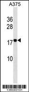 Ras Homolog Family Member F, Filopodia Associated antibody, 58-603, ProSci, Western Blot image 