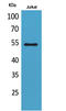 Matrix Metallopeptidase 12 antibody, STJ96502, St John