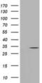 Cytidine/Uridine Monophosphate Kinase 1 antibody, NBP2-02875, Novus Biologicals, Western Blot image 