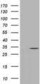 UMP-CMP kinase antibody, NBP2-02875, Novus Biologicals, Western Blot image 