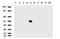 Peripherin antibody, LS-C796955, Lifespan Biosciences, Western Blot image 