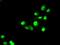 SATB Homeobox 1 antibody, GTX83685, GeneTex, Immunocytochemistry image 