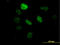 Splicing Factor 3b Subunit 2 antibody, LS-C133670, Lifespan Biosciences, Immunofluorescence image 