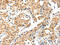 Tropomyosin 2 antibody, CSB-PA939174, Cusabio, Immunohistochemistry frozen image 