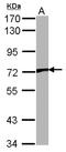 Transient Receptor Potential Cation Channel Subfamily V Member 2 antibody, LS-B4211, Lifespan Biosciences, Western Blot image 