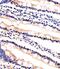 Ubiquitin Conjugating Enzyme E2 K antibody, MBS9213324, MyBioSource, Immunohistochemistry paraffin image 