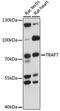 E3 ubiquitin-protein ligase TRAF7 antibody, 16-319, ProSci, Western Blot image 