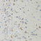 Apoptosis Inducing Factor Mitochondria Associated 3 antibody, LS-C410132, Lifespan Biosciences, Immunohistochemistry paraffin image 
