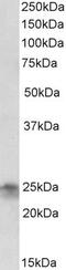 Fibroblast Growth Factor 8 antibody, PA5-37860, Invitrogen Antibodies, Western Blot image 