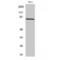 CUB Domain Containing Protein 1 antibody, LS-C382625, Lifespan Biosciences, Western Blot image 