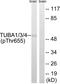 alpha-Tubulin antibody, PA5-37831, Invitrogen Antibodies, Western Blot image 