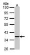 Protein Kinase X-Linked antibody, PA5-27913, Invitrogen Antibodies, Western Blot image 