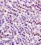 DExD/H-Box Helicase 58 antibody, orb5059, Biorbyt, Immunohistochemistry paraffin image 