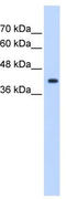 ST6 N-Acetylgalactosaminide Alpha-2,6-Sialyltransferase 5 antibody, TA339573, Origene, Western Blot image 