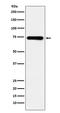 SAM And HD Domain Containing Deoxynucleoside Triphosphate Triphosphohydrolase 1 antibody, M00592, Boster Biological Technology, Western Blot image 