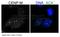 Centromere Protein M antibody, A12987, Boster Biological Technology, Immunohistochemistry paraffin image 