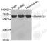 SWI/SNF Related, Matrix Associated, Actin Dependent Regulator Of Chromatin, Subfamily D, Member 1 antibody, A2273, ABclonal Technology, Western Blot image 