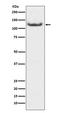 Histone Deacetylase 7 antibody, M01913, Boster Biological Technology, Western Blot image 