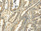 Tubulin Alpha 1c antibody, CSB-PA067976, Cusabio, Immunohistochemistry paraffin image 