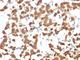 Keratin 18 antibody, V2675IHC-7ML, NSJ Bioreagents, Immunohistochemistry frozen image 