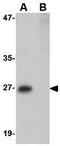 Phosphoribosyl Transferase Domain Containing 1 antibody, GTX85380, GeneTex, Western Blot image 