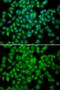 Cyclin Dependent Kinase Inhibitor 2C antibody, GTX55735, GeneTex, Immunocytochemistry image 