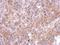 SPARC (Osteonectin), Cwcv And Kazal Like Domains Proteoglycan 3 antibody, NBP2-20476, Novus Biologicals, Immunohistochemistry paraffin image 