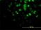 AKT Serine/Threonine Kinase 2 antibody, H00000208-M05, Novus Biologicals, Immunocytochemistry image 