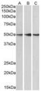 Serine/threonine-protein phosphatase 2A 56 kDa regulatory subunit epsilon isoform antibody, NB100-845, Novus Biologicals, Western Blot image 