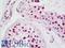hRap1 antibody, LS-B11052, Lifespan Biosciences, Immunohistochemistry paraffin image 