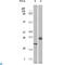 Eukaryotic Translation Initiation Factor 4E Binding Protein 1 antibody, LS-C812384, Lifespan Biosciences, Western Blot image 