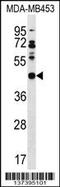 DnaJ Heat Shock Protein Family (Hsp40) Member B5 antibody, 60-040, ProSci, Western Blot image 